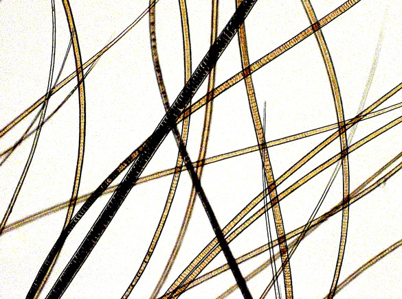 Pigmentation & Patterning in Mammals